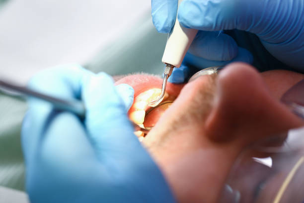 Best Chipped Tooth Repair Near Me  in Dayton, OH